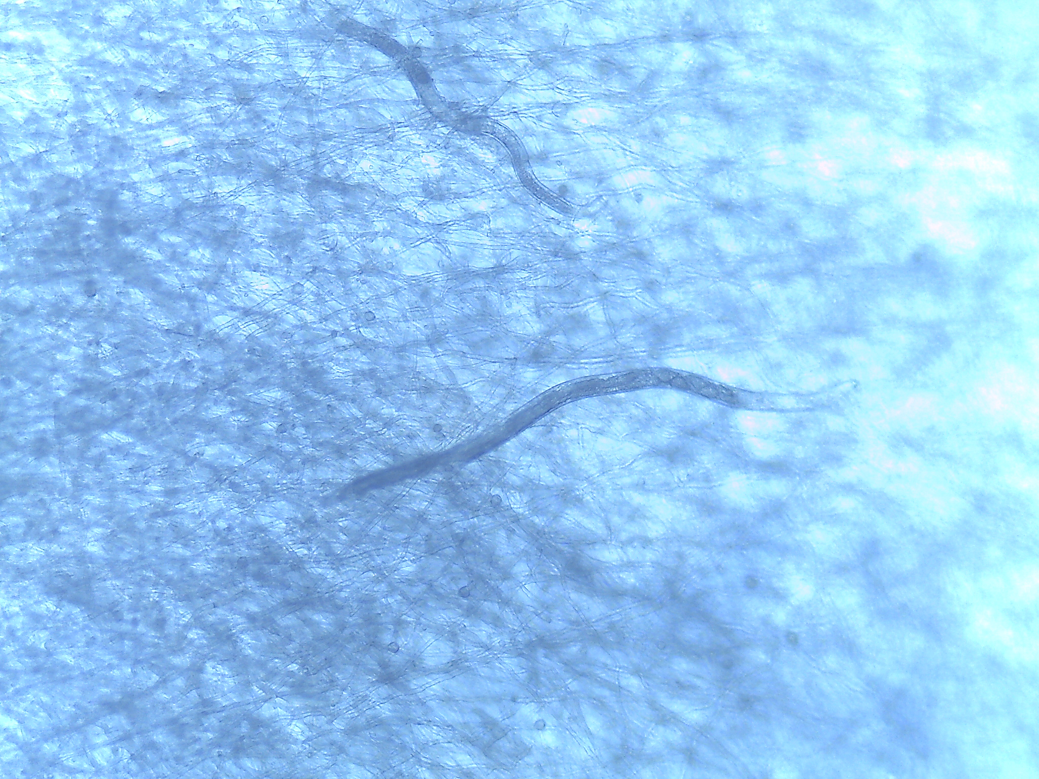 Aphelenchus avenae (a nematode) on Mortierella hyphae