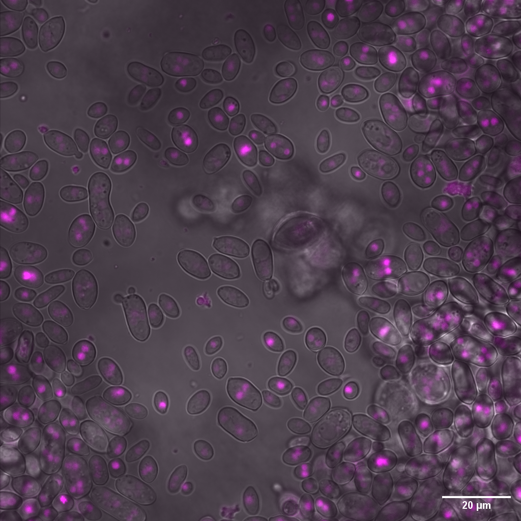 A confocal microscope image of yeast cells expressing a fluorescent protein which localizes to their nuclei. These cells vary in size and shape, and many are multi-nucleate.