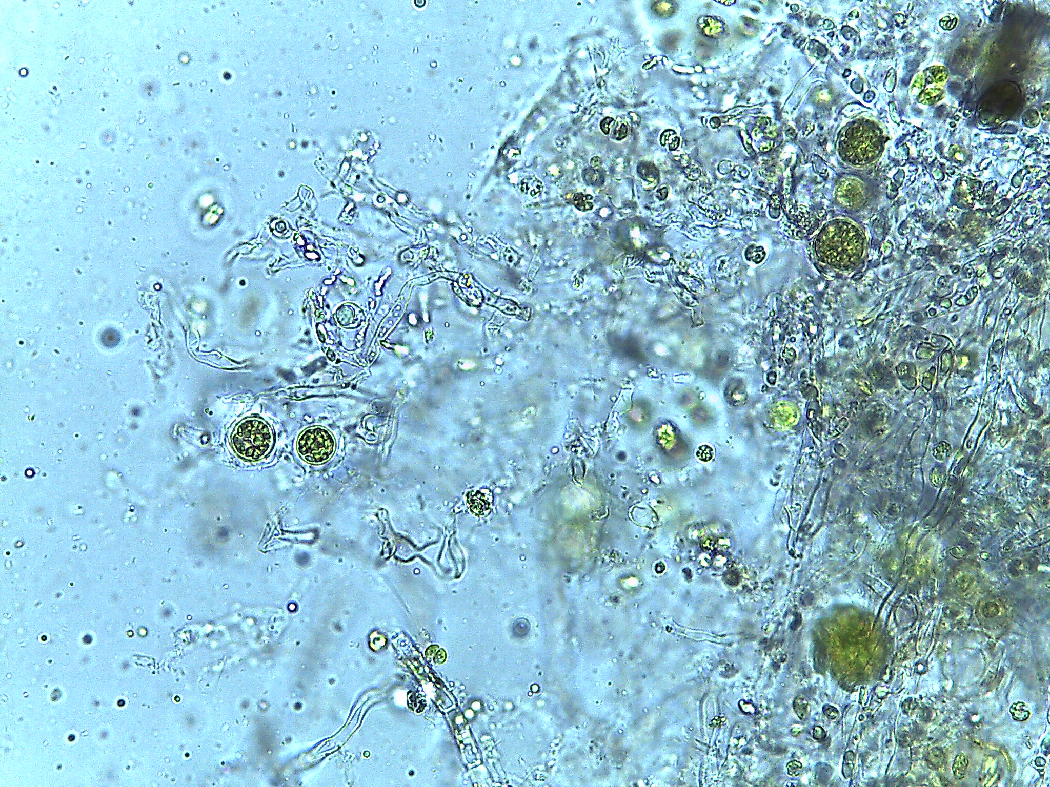 Wild algae captured in Mortierella hyphae