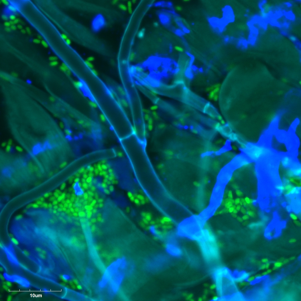 Rhizopus hyphae and fluorescent Enterobacter on Brachypodium roots