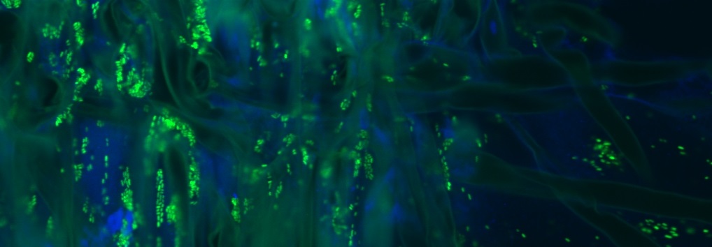 Fluorescent green Enterobacter ludwigii on Brachypodium roots